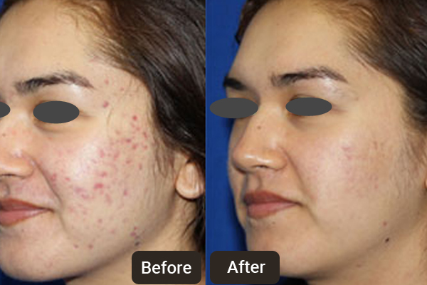 Cosmetic Dermatology Clinic in Chandigarh. Skinology+ Clinic