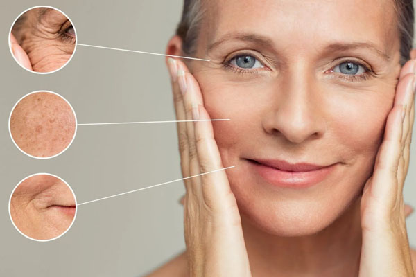 Thread Lifts: Anti-Aging Treatments by Dr. Sheenam in Chandigarh | Skinology Plus Clinic in Chandigarh