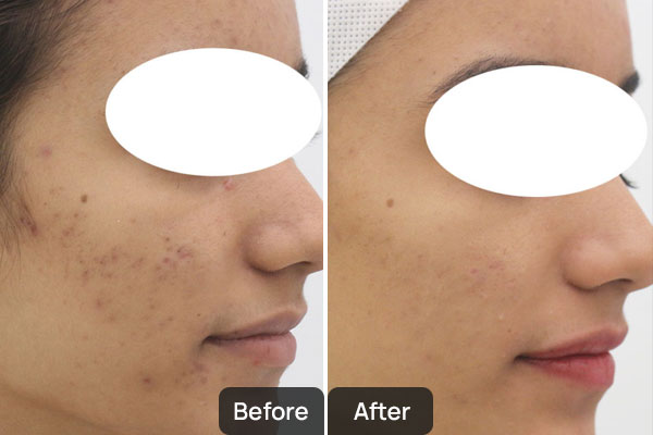 Dermatologist in Chandigarh | Skinology Plus Skin Clinic Chandigarh