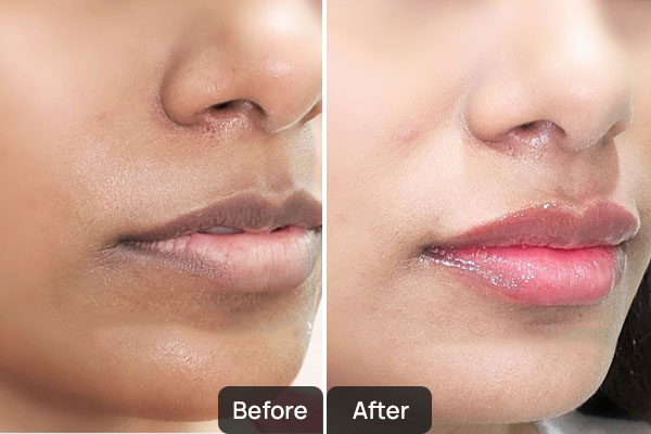 Top Dermatologist in Chandigarh | Skinology Plus by Dr. Sheenam Sharma