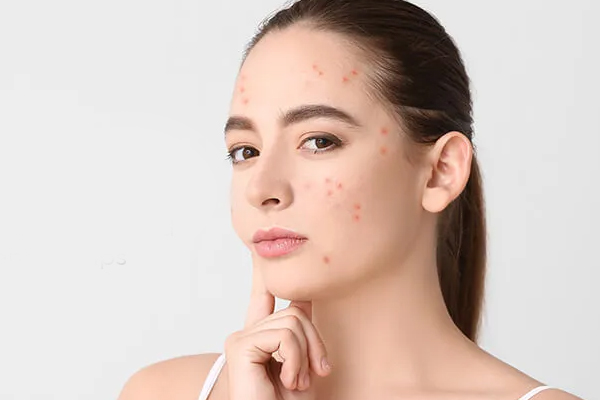 Top Dermatologist in Chandigarh