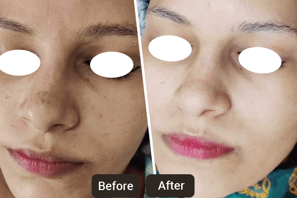 Dermatology Clinic in Chandigarh | Skinology Plus By Dr. Sheenam